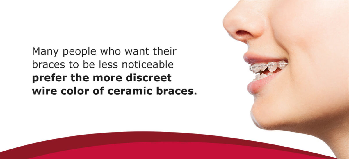 Ceramic Braces vs. Metal Braces Alizadeh & Schreiner Ortho